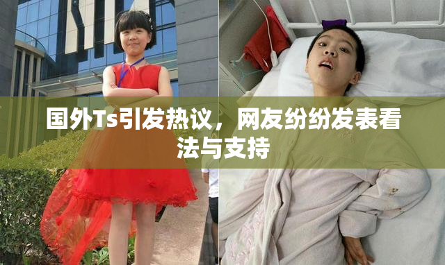 国外Ts引发热议，网友纷纷发表看法与支持