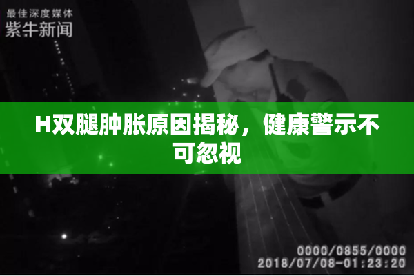H双腿肿胀原因揭秘，健康警示不可忽视