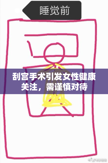 刮宫手术引发女性健康关注，需谨慎对待