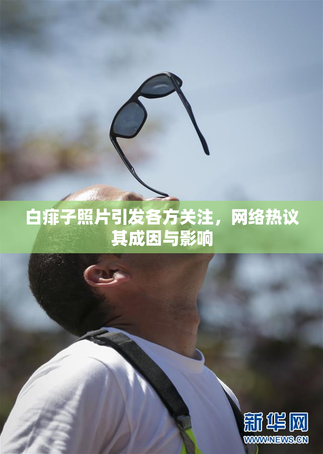 白痱子照片引发各方关注，网络热议其成因与影响