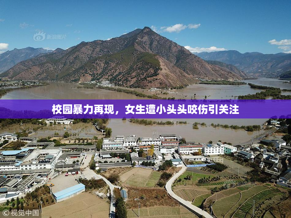 校园暴力再现，女生遭小头头咬伤引关注