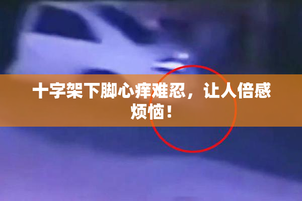 十字架下脚心痒难忍，让人倍感烦恼！