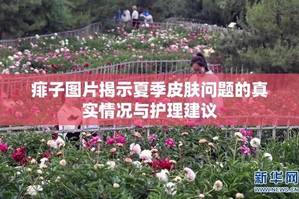 痱子图片揭示夏季皮肤问题的真实情况与护理建议