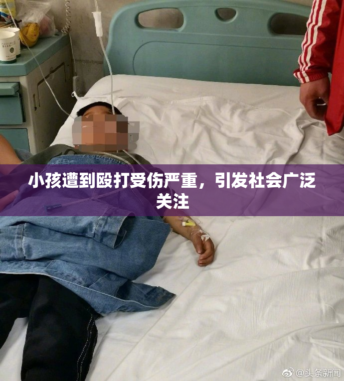 小孩遭到殴打受伤严重，引发社会广泛关注