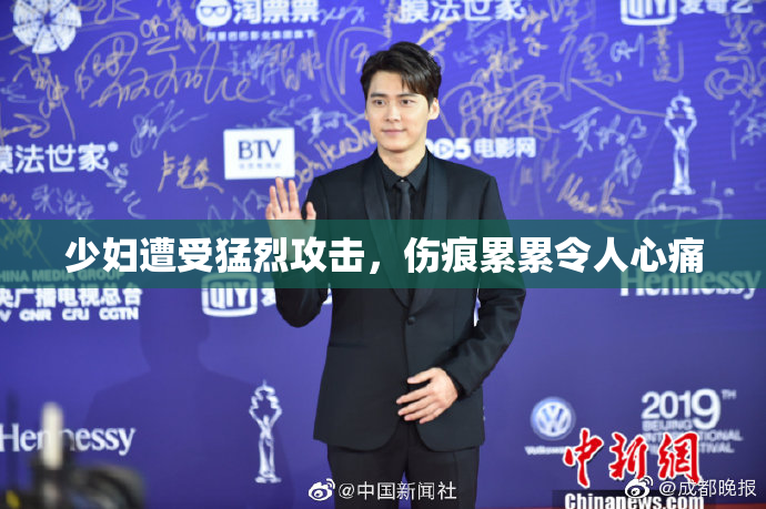 少妇遭受猛烈攻击，伤痕累累令人心痛