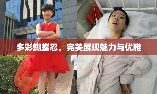 多彩蝴蝶忍，完美展现魅力与优雅