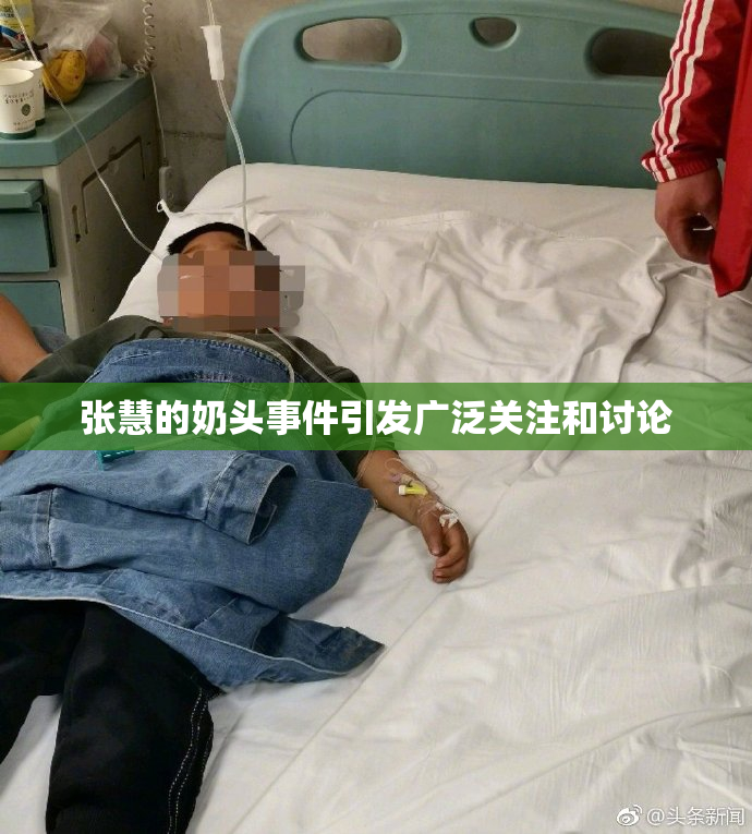 张慧的奶头事件引发广泛关注和讨论