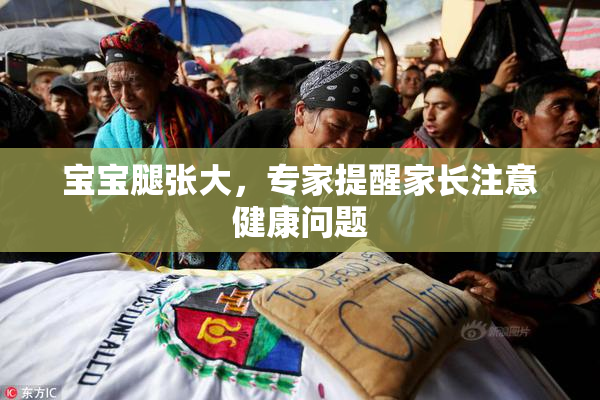 宝宝腿张大，专家提醒家长注意健康问题