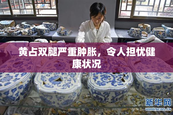 黄占双腿严重肿胀，令人担忧健康状况