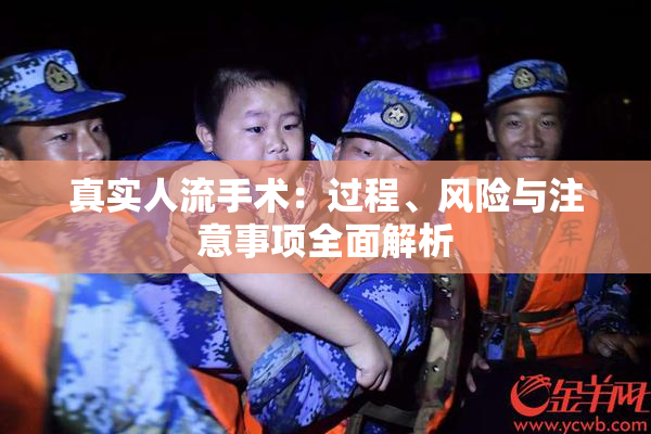 真实人流手术：过程、风险与注意事项全面解析