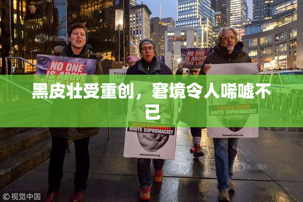 黑皮壮受重创，窘境令人唏嘘不已