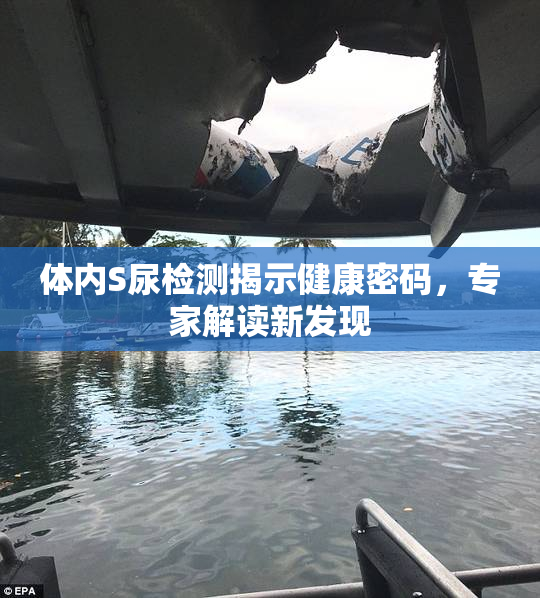 体内S尿检测揭示健康密码，专家解读新发现